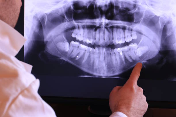 Best Tooth Infection Emergency Dentist  in Luxemburg, WI